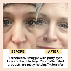 Day + Night Eye Care Bundle